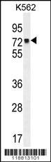 55-988 - - Анти-MLH1 Зајакот Polyclonal Антитела - Секој (400µl)